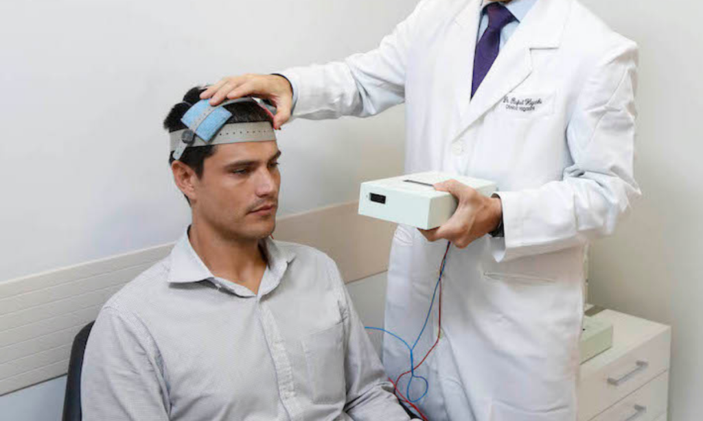 Neuromodulação cerebral com eletrodos.